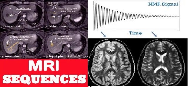 mri-sequence-and-series