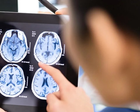 CT/ MRI in Headeches