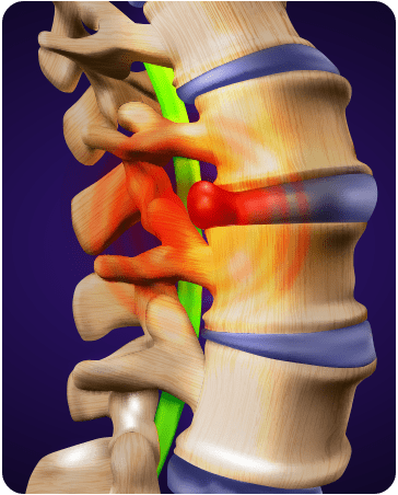 Disc-Bulge