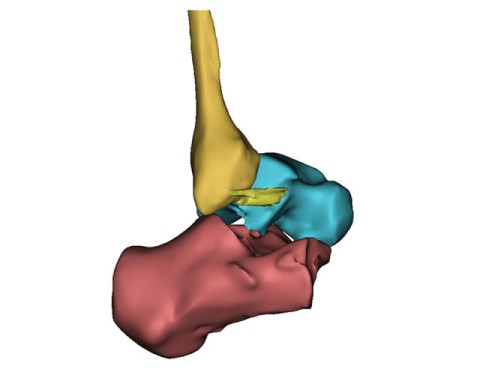 3D-Reconstruction