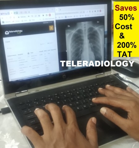 tele-radiology defination