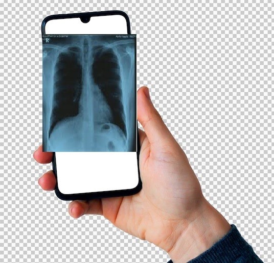 mobile_view of xray