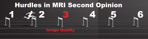 Hurdles in Second Opinion